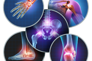 Graphic representing stress on various bones and joints